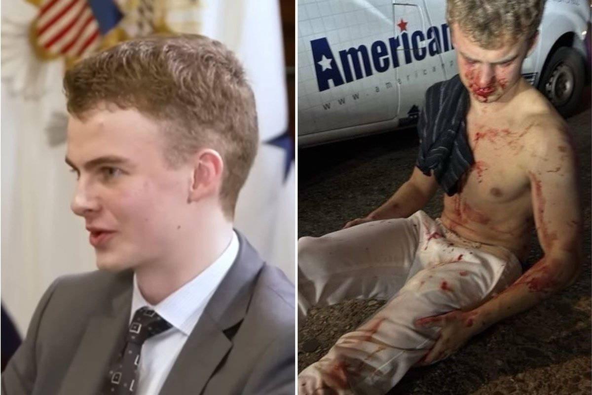 Split image of Edward Coristine speaking in a suit and sitting shirtless, bloodied after alleged assault.